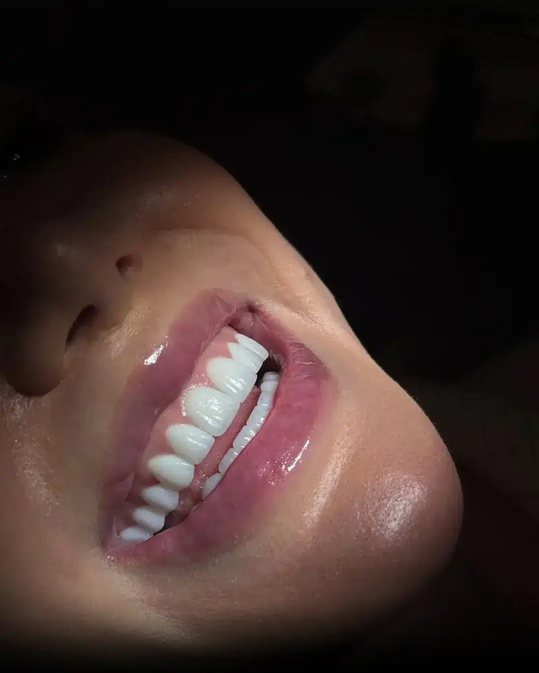 hollywood smile dr ljevo