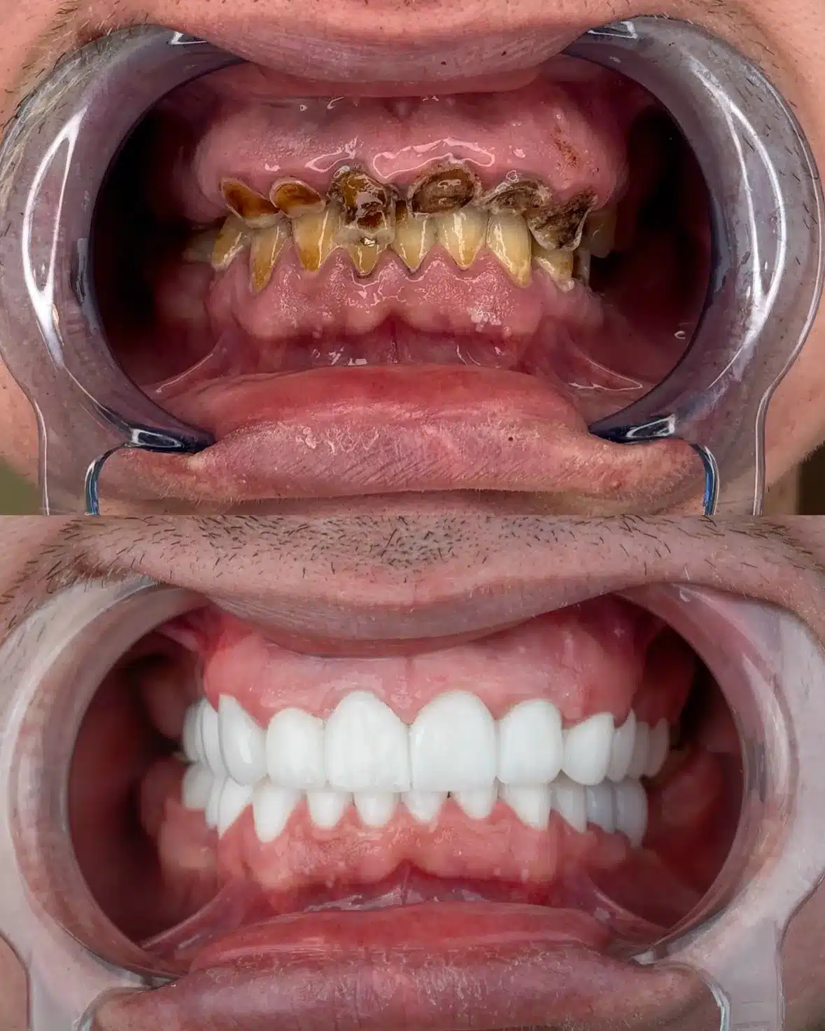 imgi_41_527326859_18024555482720239_5929617097632898736_n